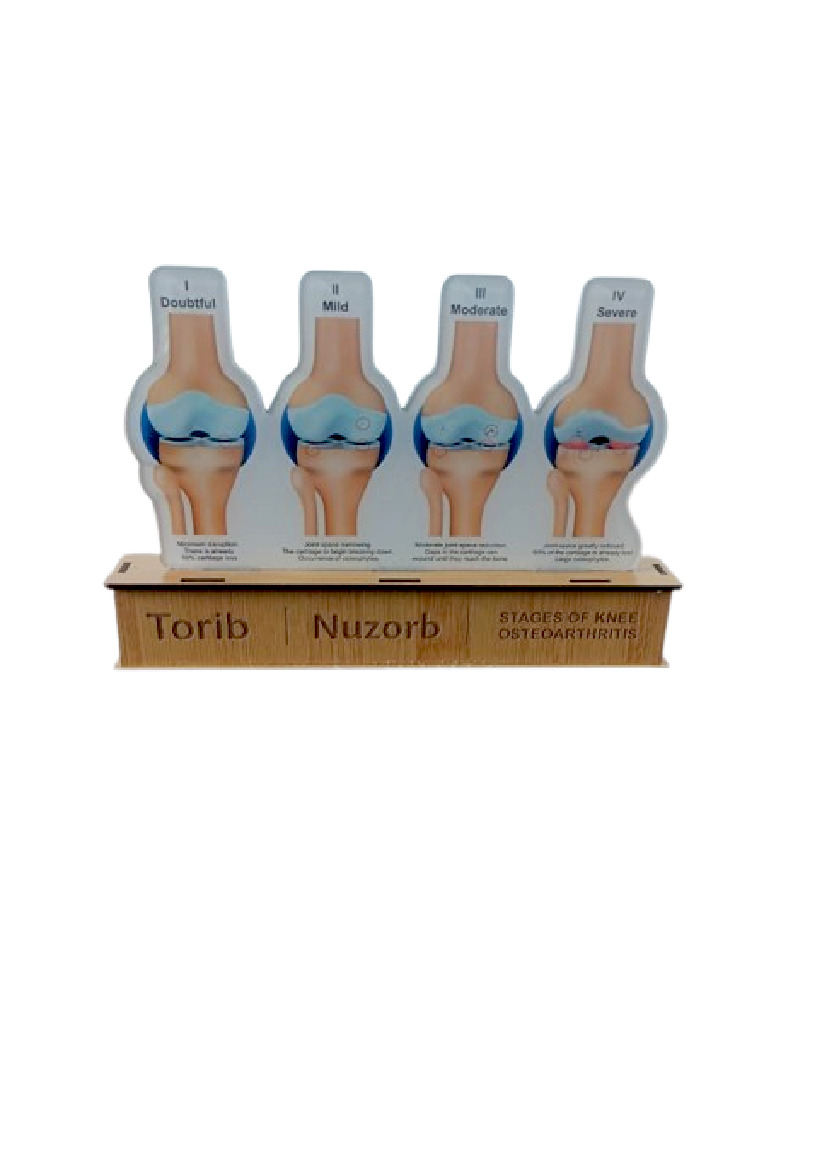 Acrylic Table Top - Ortho