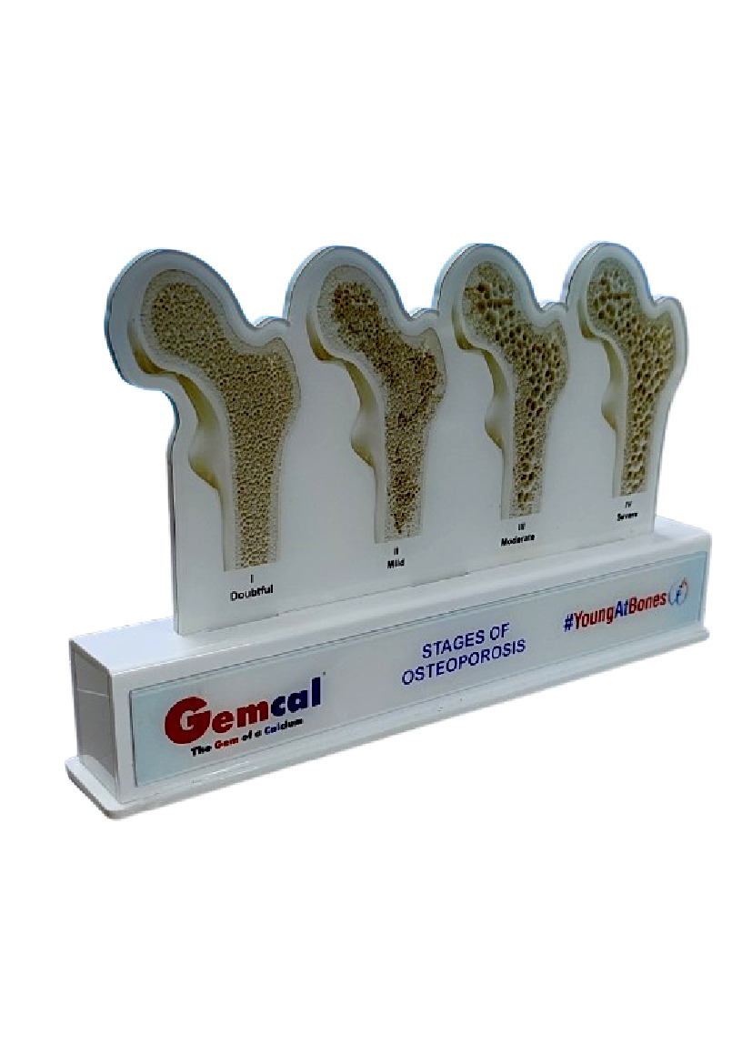 Acrylic Table Top - Ortho