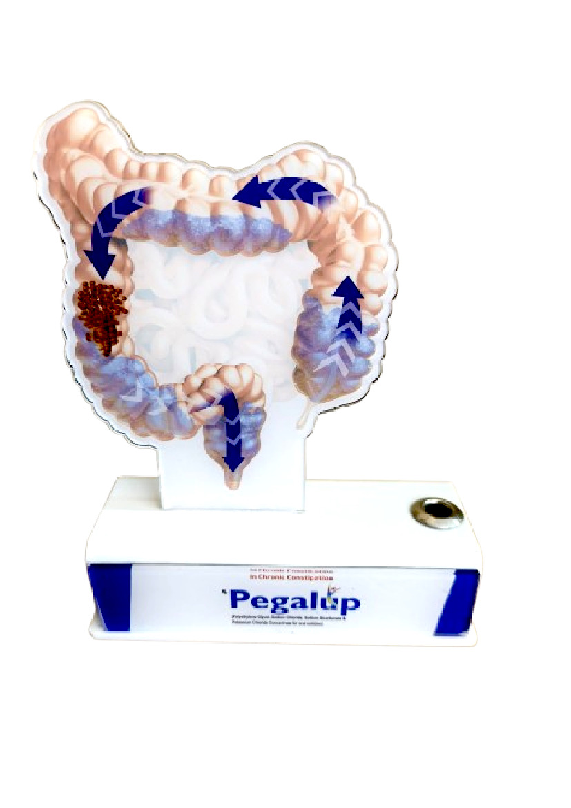 Acrylic Table Top - Gut