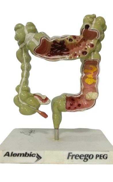 Intestine Table top