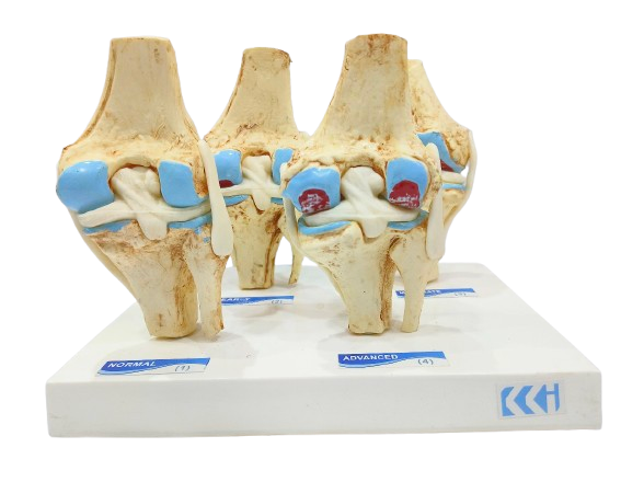 Fiber Ortho Stages Table Top