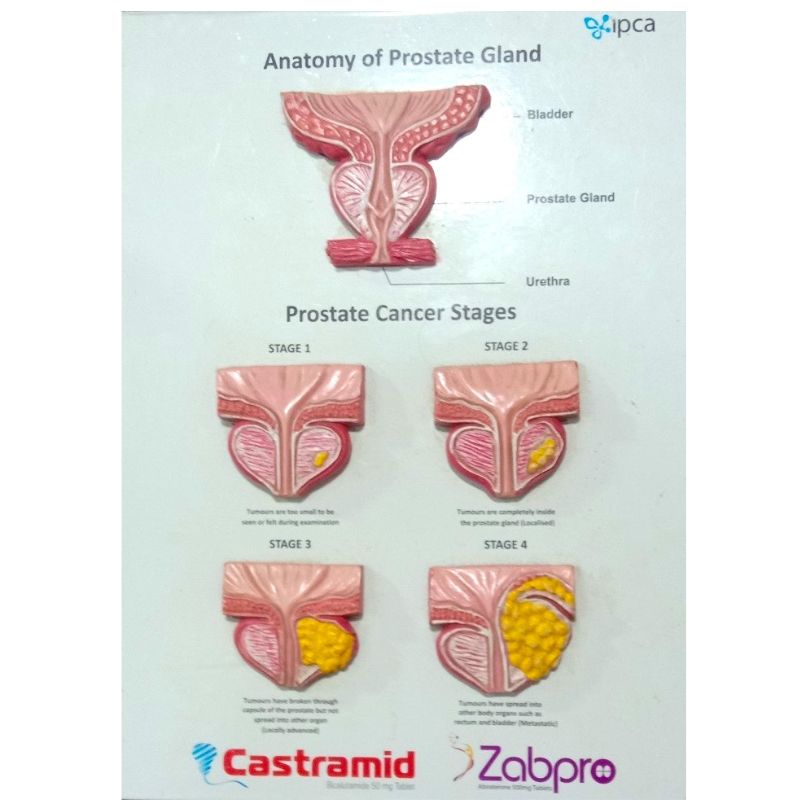 Fiber Prostrate Gland Anatomy